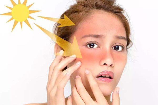 皮肤暴晒后怎么办