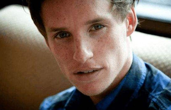 雀斑和黄褐斑的区别