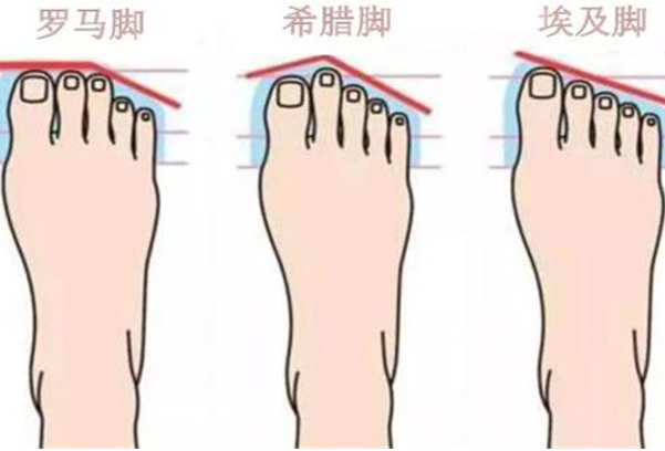 希腊脚适合穿什么鞋子