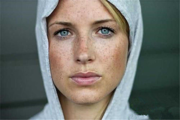 怎样祛除黄褐斑和晒斑-排行榜123网