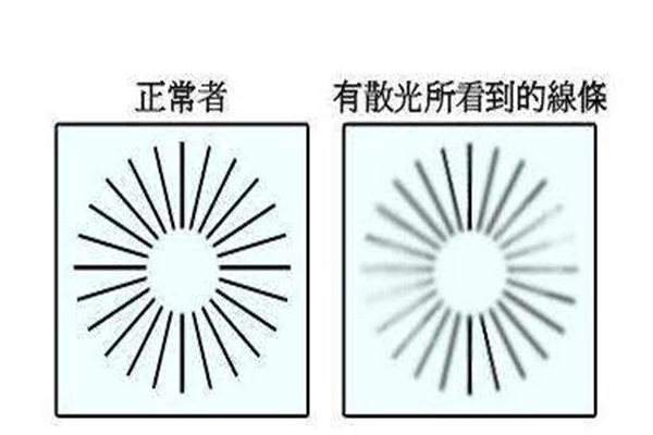 散光150怎么配隐形眼镜