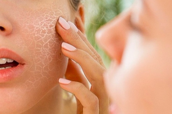 皮肤紧绷是怎么回事