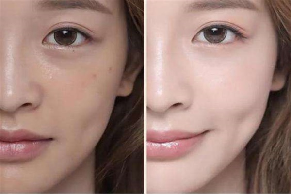 暗沉肤色是什么样的