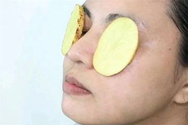 用土豆片敷脸的禁忌有哪些
